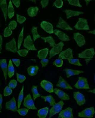 Immunocytochemistry/Immunofluorescence: FKBP12.6 Antibody [NBP3-02968] - Analysis of L929 cells using FKBP12.6 antibody at dilution of 1:100 (40x lens). Blue: DAPI for nuclear staining.