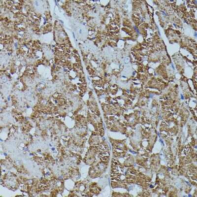 Immunohistochemistry-Paraffin: FKBP12.6 Antibody [NBP3-02968] - Paraffin-embedded rat heart using FKBP12.6 antibody at dilution of 1:100 (40x lens).