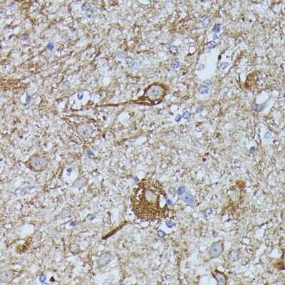 Immunohistochemistry-Paraffin: FKBP12.6 Antibody [NBP3-02968] - Paraffin-embedded mouse spinal cord using FKBP12.6 antibody at dilution of 1:100 (40x lens).