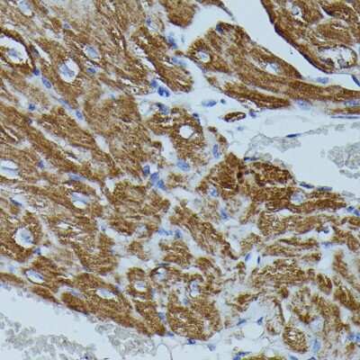 Immunohistochemistry-Paraffin: FKBP12.6 Antibody [NBP3-02968] - Immunohistochemistry of paraffin-embedded mouse heart using FKBP12.6 antibody (NBP3-02968) at dilution of 1:100 (40x lens). Perform microwave antigen retrieval with 10 mM PBS buffer pH 7.2 before commencing with IHC staining protocol.