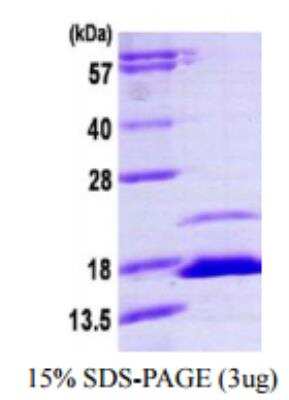 SDS-Page: Recombinant Human FKBP12.6 Protein [NBP1-72505]