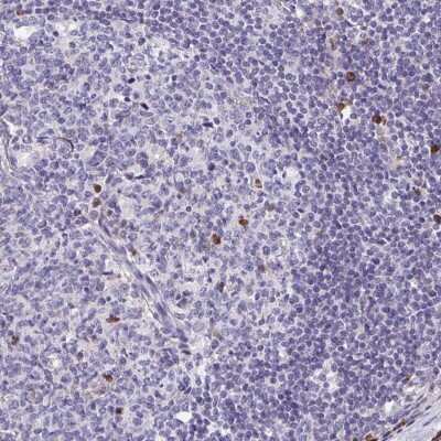 Immunohistochemistry-Paraffin: FKBP13/FKBP2 Antibody [NBP2-38604] - Staining of human lymph node shows strong cytoplasmic positivity in a subset of germinal center cells.