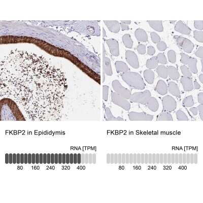 <b>Orthogonal Strategies Validation. </b>Immunohistochemistry-Paraffin: FKBP13/FKBP2 Antibody [NBP2-38604] - Staining in human epididymis and skeletal muscle tissues using anti-FKBP2 antibody. Corresponding FKBP2 RNA-seq data are presented for the same tissues.