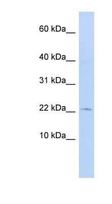 Western Blot: FKBP13/FKBP2 Antibody [NBP1-79721] - Titration: 0.2-1 ug/ml, Positive Control: 721_B cell lysate.