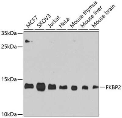 Western Blot: FKBP13/FKBP2 Antibody [NBP3-03582] - Analysis of extracts of various cell lines, using FKBP13/FKBP2 antibody at 1:1000 dilution. Secondary antibody: HRP Goat Anti-Rabbit IgG (H+L) at 1:10000 dilution. Lysates/proteins: 25ug per lane. Blocking buffer: 3% nonfat dry milk in TBST.