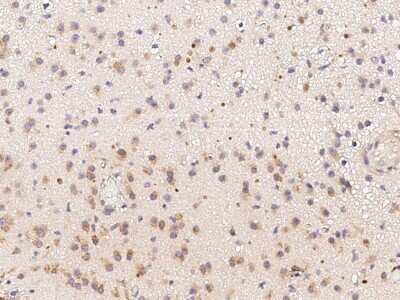 Immunohistochemistry-Paraffin: FKBP14 Antibody [NBP3-00140] - Staining of human FKBP14 in human brain with rabbit polyclonal antibody (1:1000).