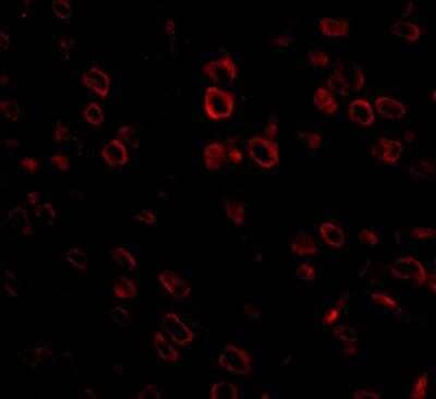 Immunocytochemistry/ Immunofluorescence FKBP15 Antibody - BSA Free