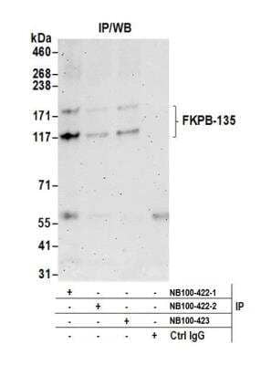 <b>Independent Antibodies Validation and Biological Strategies Validation.</b>Immunoprecipitation: FKBP15 Antibody [NB100-422] - Detection of human FKBP15 (FKPB-135) by western blot of immunoprecipitates. Samples: Whole cell lysate (0.5 or 1.0 mg per IP reaction; 20% of IP loaded) from HeLa cells prepared using NETN lysis buffer. Antibodies: Affinity purified rabbit anti-FKBP15 antibody NB100-422 (lot 2) used for IP at 6 ug per reaction. FKBP15 was also immunoprecipitated by a previous lot of this antibody (lot 1) and rabbit anti-FKBP15 antibody NB100-423. For blotting immunoprecipitated FKBP15, NB100-422 was used at 1 ug/ml. Detection: Chemiluminescence with an exposure time of 3 minutes.