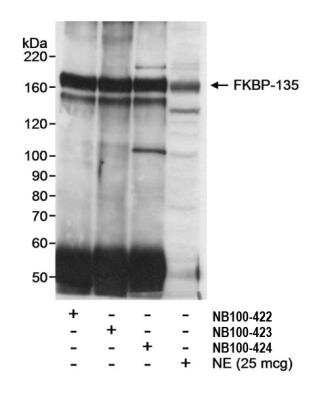 Immunoprecipitation: FKBP15 Antibody [NB100-424] - Detection of human FKBP-135 by western blot and immunoprecipitation. Samples: Nuclear extract (NE; 1 mg for IP; 25 ug for WB) from HeLa cells. Antibodies: Affinity purified rabbit anti-FKBP-135 antibodies BL1008 (NB100-422), BL1009 (NB100-423) and BL1010 (NB100-424) used at 2 ug/mg extract for IP. FKBP-135 in NE and immunoprecipitated FKBP-135 were detected using BL1008 (NB100-422) at 0.2 ug/ml. Detection: Chemiluminescence with an exposure time of 10 minutes.