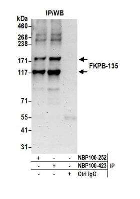 FKBP15 Antibody [NB100-423] - Detection of human FKPB-135 by western blot of immunoprecipitates. Samples: Whole cell lysate (0.5 or 1.0 mg per IP reaction; 20% of IP loaded) from HeLa cells prepared using NETN lysis buffer. Antibody: Affinity purified rabbit anti-FKPB-135 antibody NB100-423 used for IP at 6 ug per reaction. FKPB-135 was also immunoprecipitated by rabbit anti-FKPB-135 antibody NB100-252. For blotting immunoprecipitated FKPB-135, NB100-423 was used at 1 ug/ml. Detection: Chemiluminescence with an exposure time of 3 minutes.