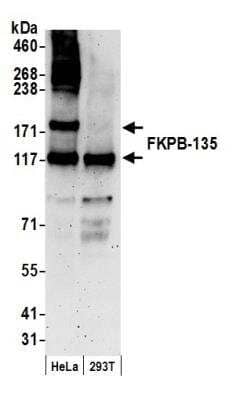 Western Blot: FKBP15 Antibody [NB100-423] - Detection of Human FKPB-135 by Western Blot. Samples: Whole cell lysate (50 ug) from HeLa and 293T cells prepared using NETN lysis buffer. Antibody: Affinity purified rabbit anti-FKPB-135 antibody NB100-423 used for WB at 0.1 ug/ml. Detection: Chemiluminescence with an exposure time of 3 minutes.