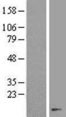 Western Blot: FKBP1B Overexpression Lysate (Adult Normal) [NBL1-10734] Left-Empty vector transfected control cell lysate (HEK293 cell lysate); Right -Over-expression Lysate for FKBP1B.