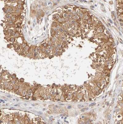 Immunohistochemistry-Paraffin: FKBP25 Antibody [NBP1-87929] - Staining of human testis shows moderate to strong cytoplasmic positivity in cells in seminiferous ducts.