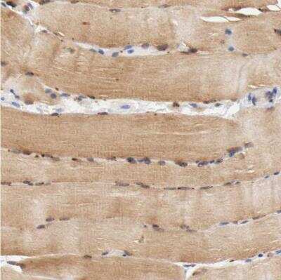 Immunohistochemistry-Paraffin: FKBP25 Antibody [NBP1-87929] - Staining of human skeletal muscle shows moderate cytoplasmic positivity in myocytes.