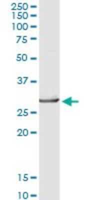Western Blot: FKBP25 Antibody [H00002287-D01P] - Analysis of FKBP3 expression in human liver.