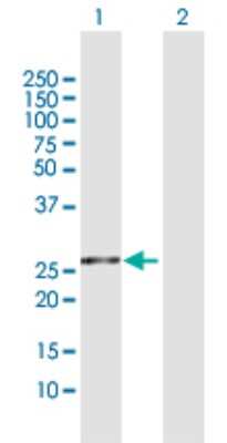 Western Blot: FKBP25 Antibody [H00002287-D01P] - Analysis of FKBP3 expression in transfected 293T cell line by FKBP3 polyclonal antibody.Lane 1: FKBP3 transfected lysate(25.20 KDa).Lane 2: Non-transfected lysate.