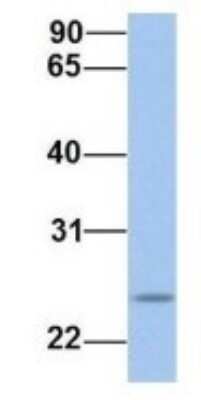 Western Blot: FKBP25 Antibody [NBP1-54354] - Human 721_B, Antibody Dilution: 1.0 ug/ml FKBP3 is supported by BioGPS gene expression data to be expressed in 721_B.