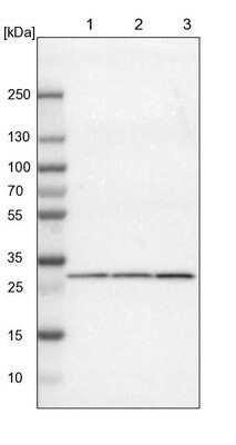 Western Blot: FKBP25 Antibody [NBP1-87929] - Lane 1: NIH-3T3 cell lysate (Mouse embryonic fibroblast cells). Lane 2: NBT-II cell lysate (Rat Wistar bladder tumor cells). Lane 3: PC12 cell lysate (Pheochromocytoma of rat adrenal medulla).