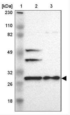 Western Blot: FKBP25 Antibody [NBP1-87929] - Lane 1: Marker [kDa] 230, 110, 82, 49, 32, 26, 18 Lane 2: Human cell line RT-4Lane 3: Human cell line U-251MG sp