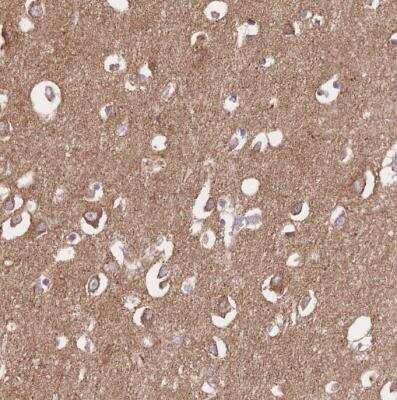 Immunohistochemistry-Paraffin: FKBP38 Antibody [NBP2-33440] -  Staining of human cerebral cortex shows moderate cytoplasmic positivity in neuronal cells and in neuropil.