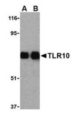 Western Blot: FKBP38 Antibody [NB110-85535] - protein A purified anti-FKBP8 antibody shows detection of exogenous FKBP8 in 50 ug of HEK293T whole cell lysate (lane 1). The results of peptide competition are shown in lane 2 where no specific staining is noted after the antibody is first incubated for 1h with the immunizing peptide in 5% BLOTTO prior to reaction with the membrane. The membrane was probed with the primary antibody at a 1:1,000 dilution in 5% BLOTTO at 4C, overnight.