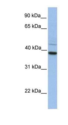 Western Blot: FKBP38 Antibody [NBP1-59019] - Hela cell lysate, concentration 0.2-1 ug/ml.