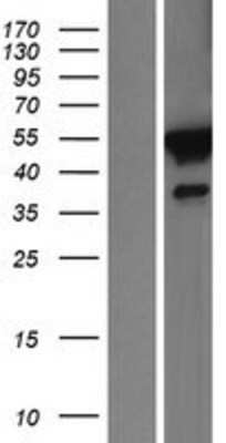 Western Blot FKBP51/FKBP5 Overexpression Lysate