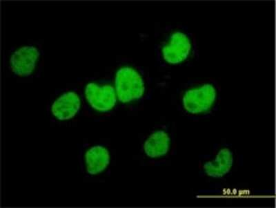 Immunocytochemistry/Immunofluorescence: FKBP51/FKBP5 Antibody (3D1-1B10) [H00002289-M02] - Analysis of monoclonal antibody to FKBP5 on HeLa cell . Antibody concentration 10 ug/ml.