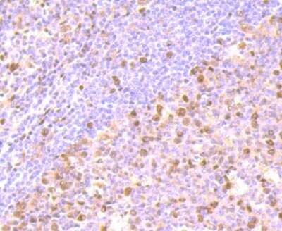 Immunohistochemistry-Paraffin: FKBP51/FKBP5 Antibody (JB95-39) [NBP2-75490] - Analysis of paraffin-embedded human tonsil tissue using anti-FKBP51 antibody. Counter stained with hematoxylin.