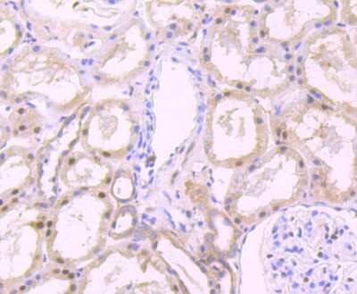 Immunohistochemistry-Paraffin: FKBP51/FKBP5 Antibody (JB95-39) [NBP2-75490] - Analysis of paraffin-embedded human kidney tissue using anti-FKBP51 antibody. Counter stained with hematoxylin.