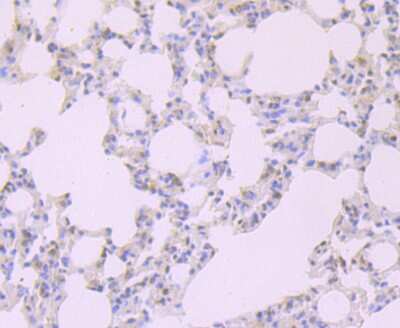 Immunohistochemistry-Paraffin: FKBP51/FKBP5 Antibody (JB95-39) [NBP2-75490] - Analysis of paraffin-embedded rat lung tissue tissue using anti-FKBP51 antibody. Counter stained with hematoxylin.