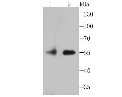 Western Blot: FKBP51/FKBP5 Antibody (JB95-39) [NBP2-75490] - Analysis of FKBP51 on rat kidney tissue and Daudi cell lysate using anti-FKBP51 antibody at 1/500 dilution.