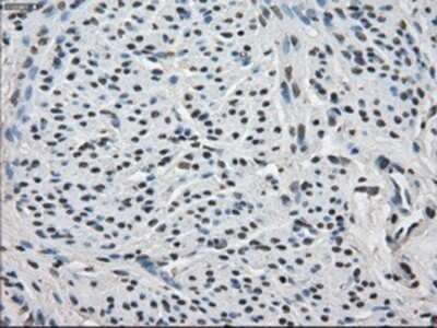 Immunohistochemistry: FKBP51/FKBP5 Antibody (OTI3E9) - Azide and BSA Free [NBP2-70742] - Staining of paraffin-embedded endometrium tissue using anti-FKBP5/FKBP51 mouse monoclonal antibody.