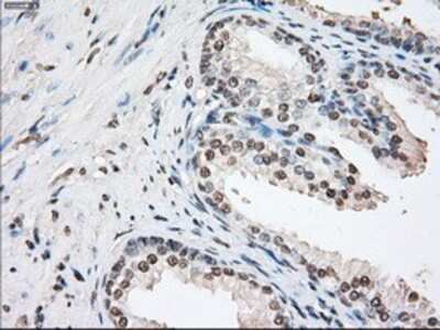 Immunohistochemistry: FKBP51/FKBP5 Antibody (OTI3E9) - Azide and BSA Free [NBP2-70742] - Staining of paraffin-embedded prostate tissue using anti-FKBP5/FKBP51 mouse monoclonal antibody.