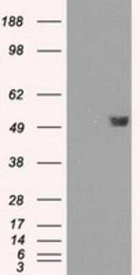 Western Blot: FKBP51/FKBP5 Antibody (OTI3E9) - Azide and BSA Free [NBP2-70742] - HEK293T cells were transfected with the pCMV6-ENTRY control (Left lane) or pCMV6-ENTRY FKBP5/FKBP51 (Right lane) cDNA for 48 hrs and lysed. Equivalent amounts of cell lysates (5 ug per lane) were separated by SDS-PAGE and immunoblotted with anti-FKBP5/FKB