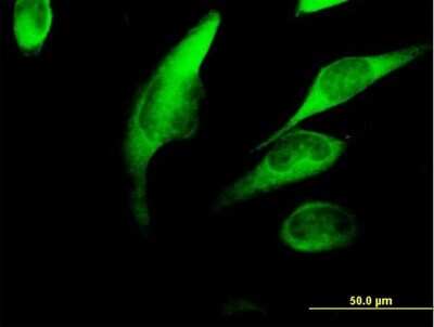 Immunocytochemistry/Immunofluorescence: FKBP52/FKBP4 Antibody [H00002288-B01P] - Analysis of purified antibody to FKBP4 on HeLa cell. (antibody concentration 10 ug/ml)