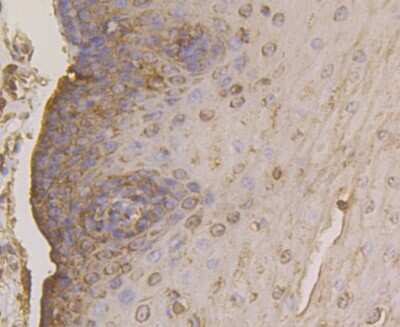 Immunohistochemistry-Paraffin: FKBP52/FKBP4 Antibody (JG96-30) [NBP2-75491] - Analysis of paraffin-embedded human esophagus tissue using anti-FKBP52 antibody. Counter stained with hematoxylin.