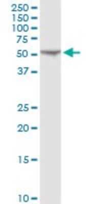 Western Blot: FKBP52/FKBP4 Antibody [H00002288-D01P] - Analysis of FKBP4 expression in Jurkat.