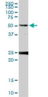 Western Blot: FKBP52/FKBP4 Antibody [H00002288-D01P] - Analysis of FKBP4 expression in human pancreas.