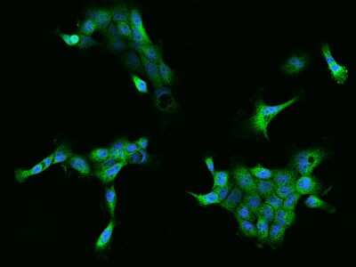 Immunocytochemistry/Immunofluorescence: FKBP6 Antibody [NBP2-97729] - Immunofluorescence staining of FKBP6 in A431 cells. Cells were fixed with 4% PFA, permeabilzed with 0.1% Triton X-100 in PBS, blocked with 10% serum, and incubated with rabbit anti-Human FKBP6 polyclonal antibody (dilution ratio 1:200) at 4C overnight. Then cells were stained with the Alexa Fluor(R)488-conjugated Goat Anti-rabbit IgG secondary antibody (green) and counterstained with DAPI (blue).Positive staining was localized to Cytoplasm.