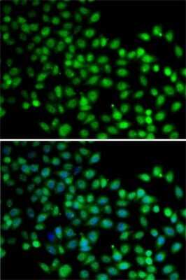 Immunocytochemistry/Immunofluorescence: FKBP6 Antibody [NBP3-04676] - Analysis of A-549 cells using FKBP6 antibody . Blue: DAPI for nuclear staining.