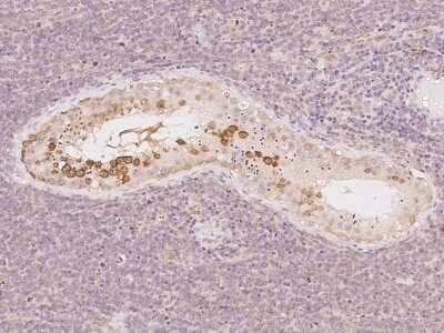 Immunohistochemistry-Paraffin: FKBP6 Antibody [NBP2-97729] - Immunochemical staining of human FKBP6 in human testis with rabbit polyclonal antibody at 1:100 dilution, formalin-fixed paraffin embedded sections.