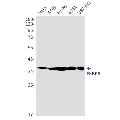 Western Blot: FKBP6 Antibody (S05-4G2) [NBP3-19865] - Western blot detection of FKBP6 in Hela, A549, HL-60, U251, U87-MG cell lysates using NBP3-19865 (1:1000 diluted). Predicted band size: 37kDa. Observed band size: 37kDa.