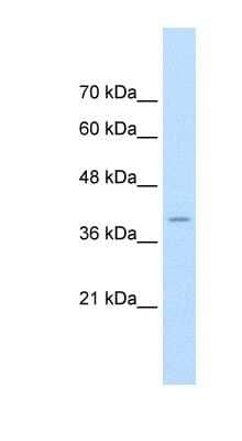 Western Blot FKBP6 Antibody