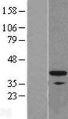 Western Blot FKBP6 Overexpression Lysate