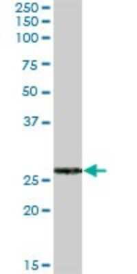 Western Blot: FKBP7 Antibody [H00051661-B02P] - Analysis of FKBP7 expression in human liver.