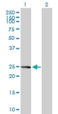 Western Blot: FKBP7 Antibody [H00051661-B02P] - Analysis of FKBP7 expression in transfected 293T cell line by FKBP7 polyclonal antibody.  Lane 1: FKBP7 transfected lysate(24.42 KDa). Lane 2: Non-transfected lysate.