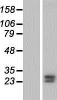 Western Blot: FKBP7 Overexpression Lysate (Adult Normal) [NBP2-04932] Left-Empty vector transfected control cell lysate (HEK293 cell lysate); Right -Over-expression Lysate for FKBP7.