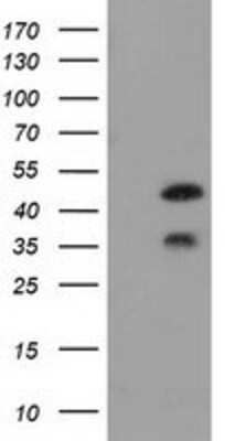 Western Blot: FKBPL Antibody (2D8) [NBP2-03407] - HEK293T cells were transfected with the pCMV6-ENTRY control (Left lane) or pCMV6-ENTRY FKBPL (Right lane) cDNA for 48 hrs and lysed. Equivalent amounts of cell lysates (5 ug per lane) were separated by SDS-PAGE and immunoblotted with anti-FKBPL.