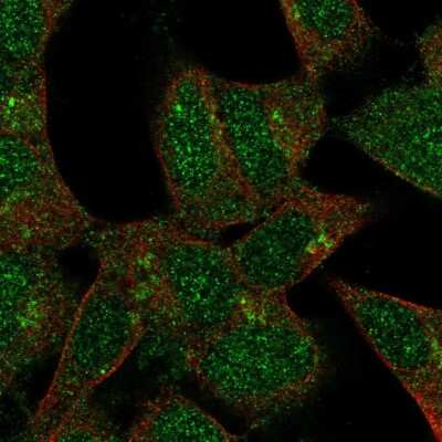 Immunocytochemistry/Immunofluorescence: FKRP Antibody [NBP2-55584] - Staining of human cell line SH-SY5Y shows localization to nucleus, cytosol & the Golgi apparatus.